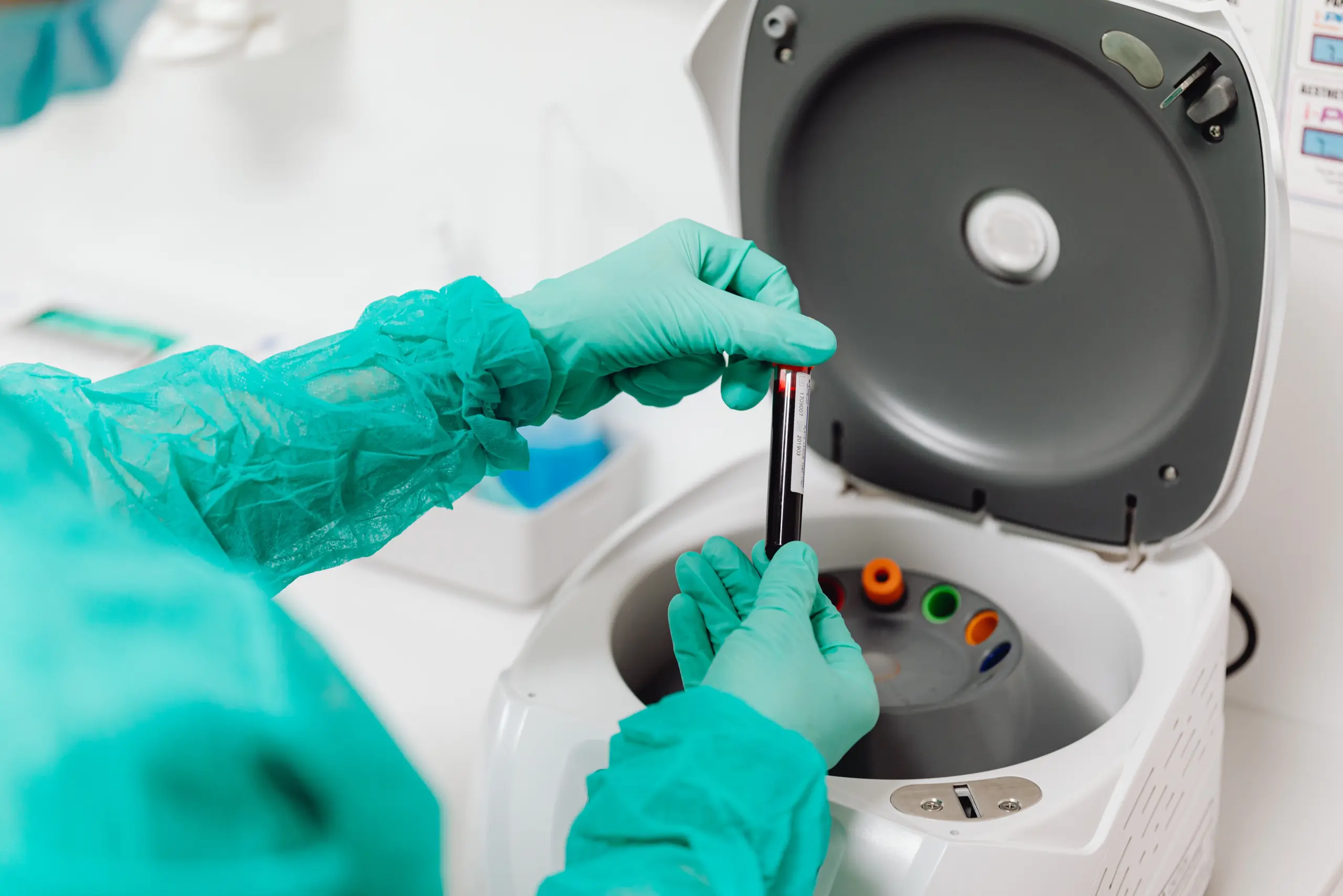 Zentrifuge mit Proben – Laborwerte zuverlässig bestimmen