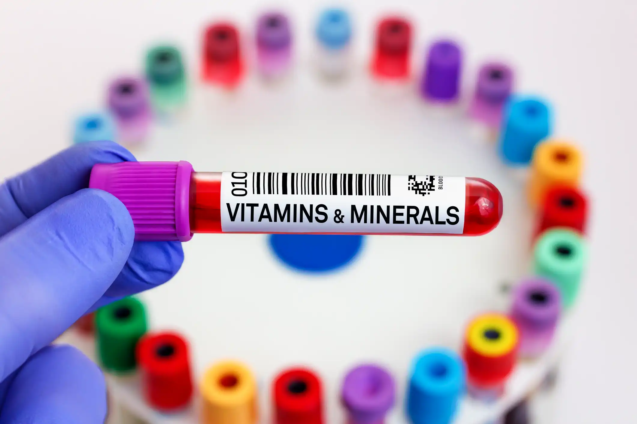 Kalium: Funktion, Normwerte & Ernährung – zu niedrig/zu hoch 4 Kalium Blutbild – Blutröhrchen im Labor für Gesundheit, Hypokaliämie & Hyperkaliämie