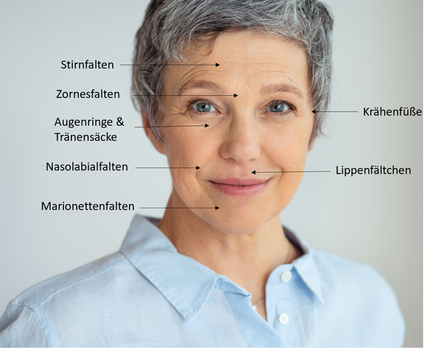 Hyaluron Spritzen München - Hyaluron Filler Behandlung 51 Verschiedene Gesichtsfalten Beschriftung
hyaluron spritzen münchen
hyaluron faltenunterspritzung kosten
hyaluron unterspritzung münchen
filler behandlung münchen
hyaluron gesicht behandlung