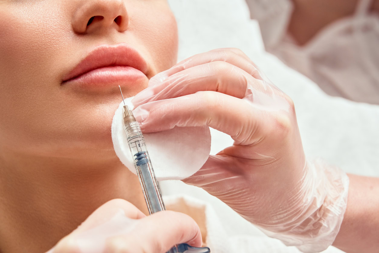 Lippenvergrößerung: Schönere Lippen mit Hyaluronsäure-Fillern 52 Lippenvergrößerung
Lippenunterspritzung
Lippen Filler
hyaluronsäure filler
lippen aufspritzen preise