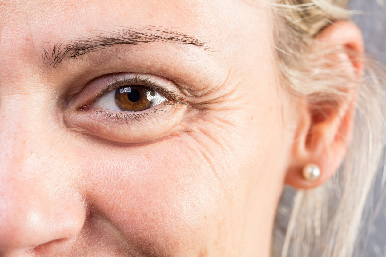 Botox Behandlung - Hausarztpraxis am Romanplatz 48 iStock 1460731504 1