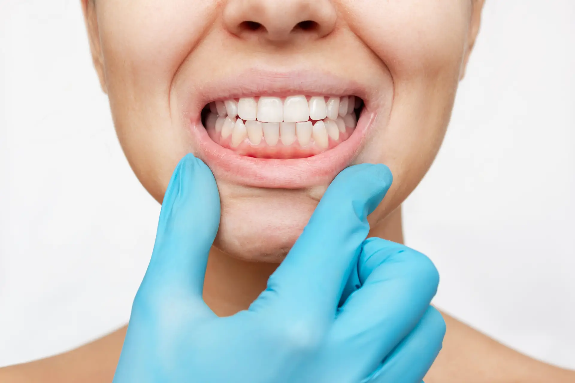 Bruxismus/Zähneknirschen: Ursachen & Botox Behandlung 4 Illustration: Kiefergelenk, Kaumuskulatur und Zähne – Zähneknirschen verstehen