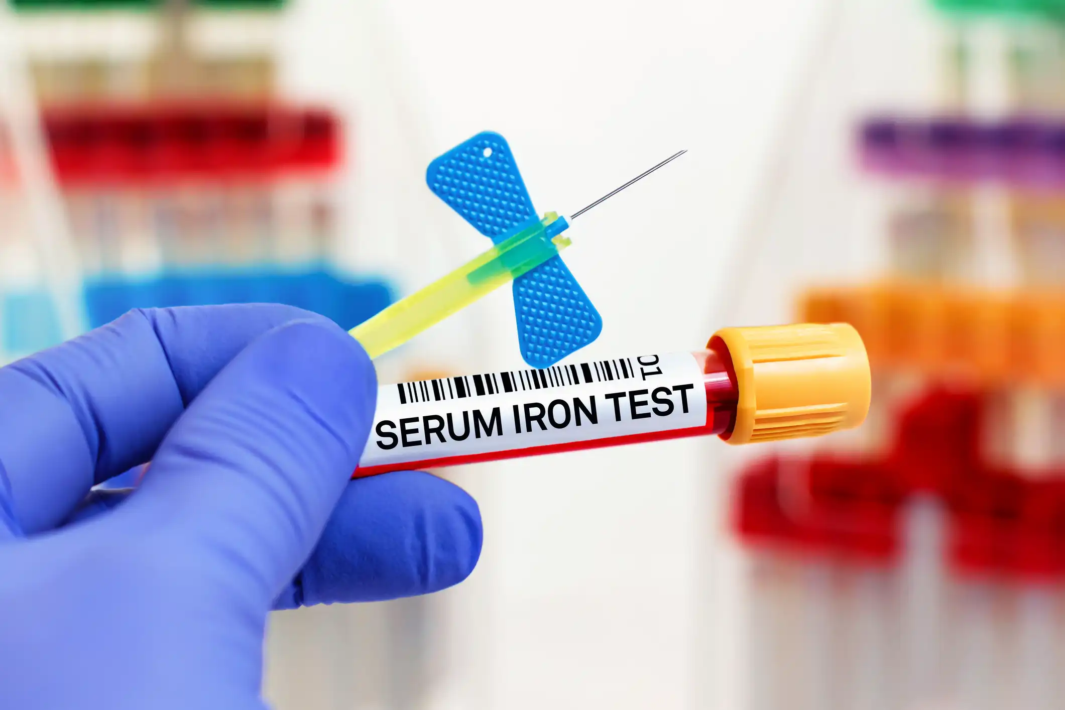Eisenmangel: Ursachen, Symptome und Behandlung 5 Probenröhrchen – Ferritin, TSAT & Hb bestimmen