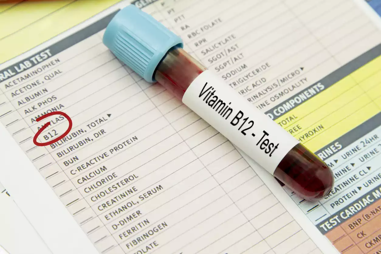 Vitamin B12 Bluttest: Diagnose mit Serum-B12, Holotranscobalamin und MMA