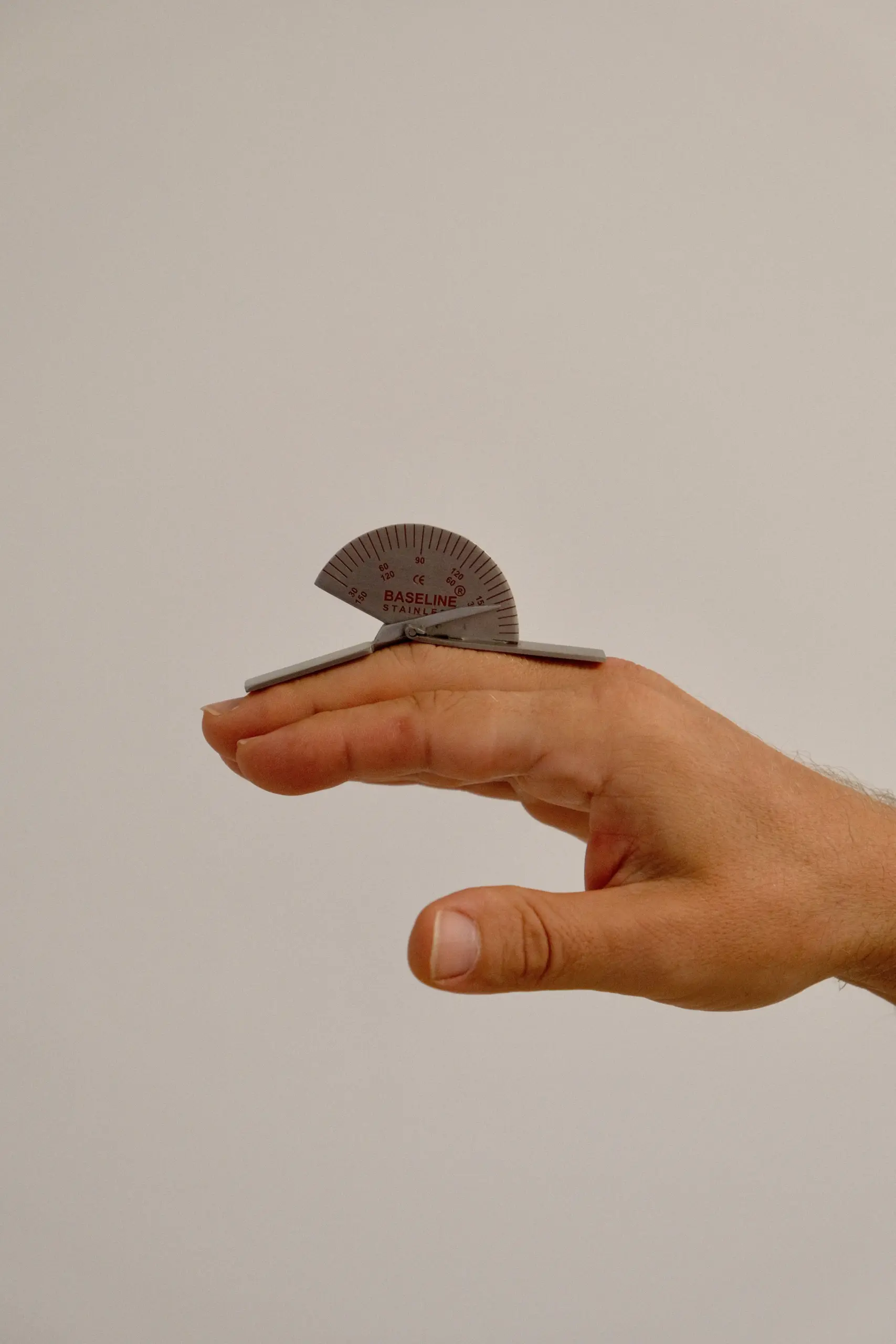 Dupuytren Symptome und Streckdefizit: Winkelmessung der Finger in München am Romanplatz